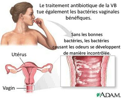 Comme enlever les boutons de la personne un jour